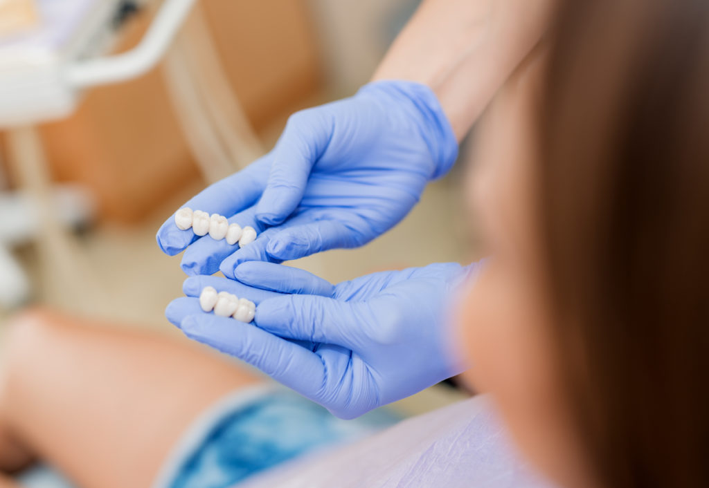 Dentista mostra dentes de porcelana para paciente, um material utilizado também na lente de contato dental. 