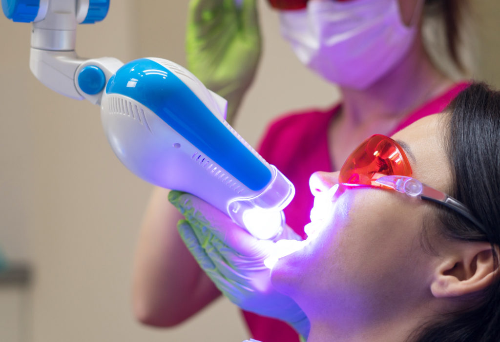 Mulher recebendo aplicação de clareamento dental no consultório.